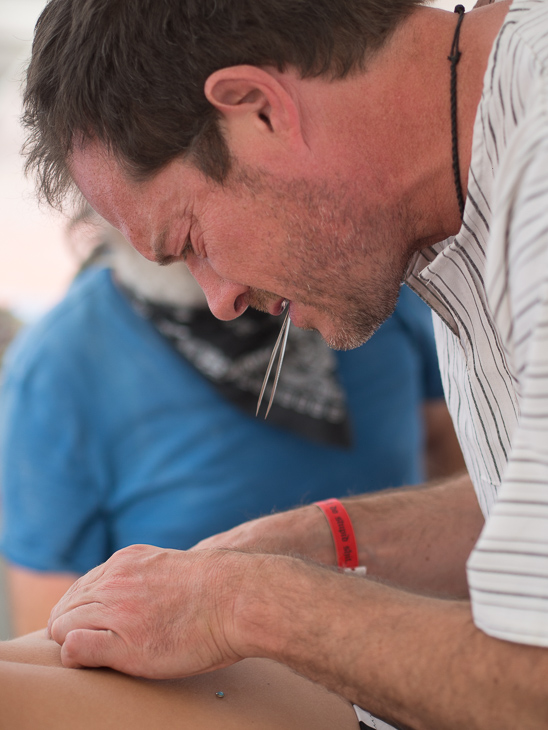 Tom Tom Operating on Leslie, Burning Man photo